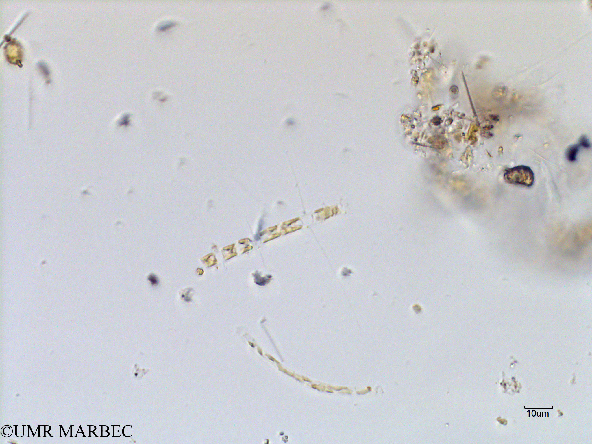 phyto/Scattered_Islands/mayotte_lagoon/SIREME May 2016/Chaetoceros holsaticus (MAY3_cf chaetoceros sp34-4).tif(copy).jpg